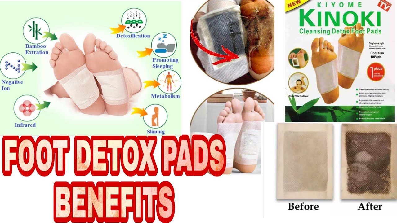 Kinoki Detox Foot Patches (Set of 10)