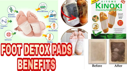 Kinoki Detox Foot Patches (Set of 10)